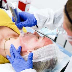 Medical aesthetician performing vampire facial on patient.
