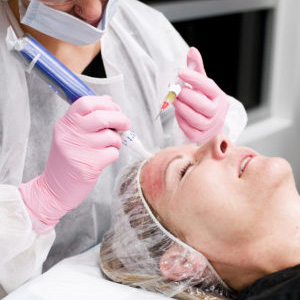 Medical aesthetician performing vampire facial on patient.